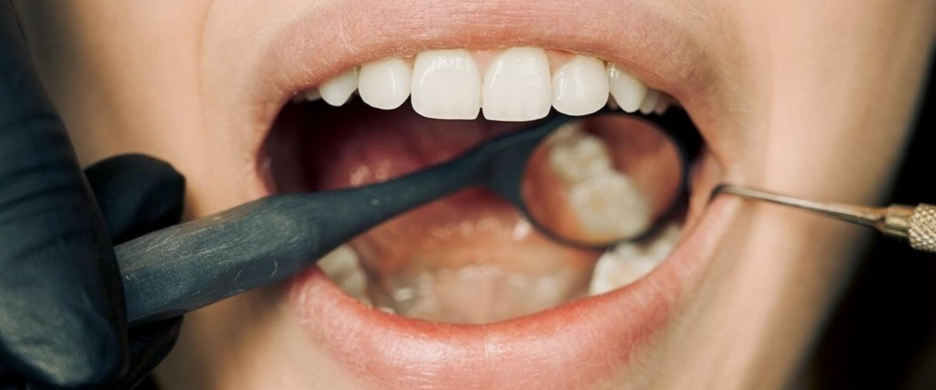 The Meridian Tooth-Body Connection: Understanding the Link Between Oral Health and Overall Well-being